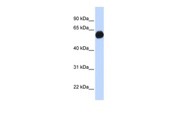 Aviva Systems Biology Corp AKAP1 Antibody - C-terminal region (ARP36334_P050)