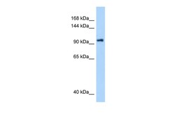 Aviva Systems Biology Corp DHX16 Antibody - N-terminal region (ARP36356_P050)