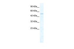 Aviva Systems Biology Corp CHD1L Antibody - middle region (ARP36364_T100)
