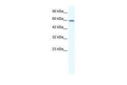 Aviva Systems Biology Corp DDX5 Antibody - C-terminal region (ARP36365_T100)
