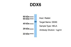 Aviva Systems Biology Corp DDX6 Antibody - N-terminal region (ARP36367_P050)