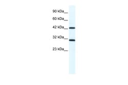 Aviva Systems Biology Corp DDX39 Antibody - N-terminal region (ARP36384_T100)