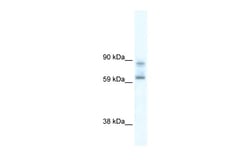 Aviva Systems Biology Corp DDX42 Antibody - N-terminal region (ARP36403_P050)