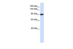 Aviva Systems Biology Corp RAD54B Antibody - N-terminal region (ARP36406_P050)