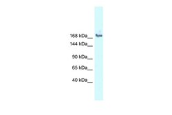 Aviva Systems Biology Corp SNRNP200 Antibody - N-terminal region (ARP36414_P050)