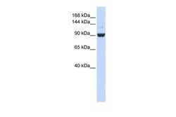 Aviva Systems Biology Corp DHX34 Antibody - middle region (ARP36417_P050)