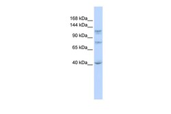 Aviva Systems Biology Corp DHX30 Antibody - N-terminal region (ARP36425_P050)