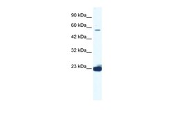 Aviva Systems Biology Corp DDX55 Antibody - C-terminal region (ARP36479_T100)