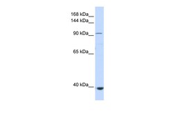 Aviva Systems Biology Corp IFIH1 Antibody - middle region (ARP36486_P050)