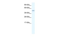Aviva Systems Biology Corp TMEM108 Antibody - middle region (ARP36495_T100)