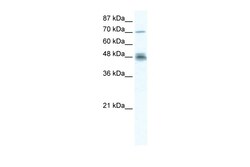 Aviva Systems Biology Corp DDX50 Antibody - N-terminal region (ARP36497_T100)