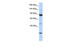 Aviva Systems Biology Corp TDRD9 Antibody - middle region (ARP36532_P050)