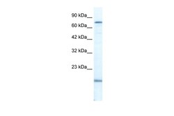 Aviva Systems Biology Corp PGBD3 Antibody - N-terminal region (ARP36534_T100)