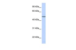 Aviva Systems Biology Corp ADRB1 Antibody - middle region (ARP36551_P050)