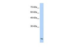 Aviva Systems Biology Corp AES Antibody - C-terminal region (ARP36553_T100)