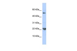 Aviva Systems Biology Corp TNFSF12 Antibody - N-terminal region (ARP36558_P050)