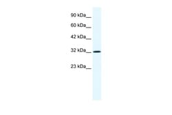 Aviva Systems Biology Corp ANXA1 Antibody - N-terminal region (ARP36568_T100)