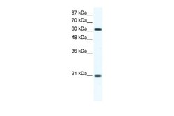 Aviva Systems Biology Corp Anxa6 Antibody - C-terminal region (ARP36582_T100)