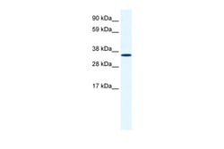 Aviva Systems Biology Corp ANXA2 Antibody - C-terminal region (ARP36588_T100)