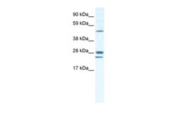 Aviva Systems Biology Corp GJB2 Antibody - middle region (ARP36608_T100)