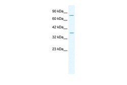 Aviva Systems Biology Corp MCM4 Antibody - middle region (ARP36649_T100)