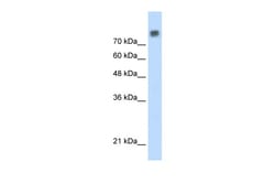 Aviva Systems Biology Corp MCM6 Antibody - C-terminal region (ARP36650_P050)
