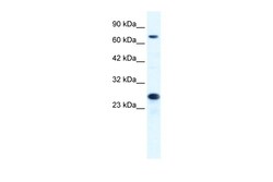 Aviva Systems Biology Corp MCM6 Antibody - C-terminal region (ARP36650_T100)