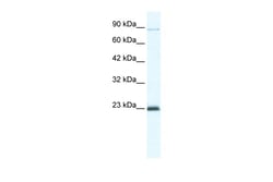 Aviva Systems Biology Corp MCM4 Antibody - C-terminal region (ARP36663_T100)