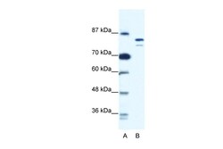 Aviva Systems Biology Corp MCM8 Antibody - N-terminal region (ARP36669_T100)