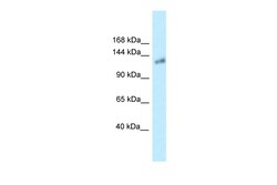 Aviva Systems Biology Corp Kl Antibody - N-terminal region (ARP36671_P050)