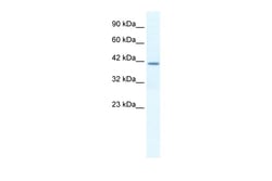Aviva Systems Biology Corp SPP1 Antibody - C-terminal region (ARP36677_T100)