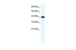 Aviva Systems Biology Corp IBSP Antibody - N-terminal region (ARP36681_T100)