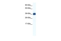 Aviva Systems Biology Corp CX36 Antibody - middle region (ARP36685_T100)