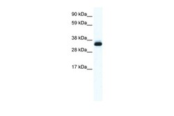 Aviva Systems Biology Corp ANXA5 Antibody - N-terminal region (ARP36687_T100)