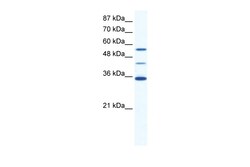 Aviva Systems Biology Corp ALX4 Antibody - N-terminal region (ARP36700_T100)