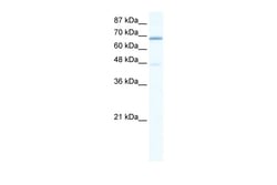 Aviva Systems Biology Corp CACNB2 Antibody - C-terminal region (ARP36761_P050)