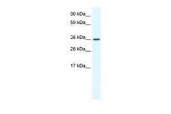 Aviva Systems Biology Corp TRPM3 Antibody - N-terminal region (ARP36768_T100)