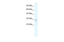 Aviva Systems Biology Corp TRPM3 Antibody - N-terminal region (ARP36771_T100)