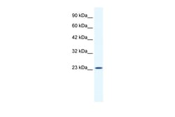 Aviva Systems Biology Corp KCTD11 Antibody - N-terminal region (ARP36786_T100)