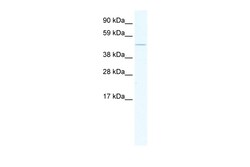 Aviva Systems Biology Corp EGR1 Antibody - N-terminal region (ARP36841_T100)