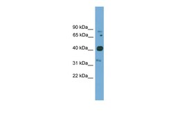 Aviva Systems Biology Corp Foxq1 Antibody - N-terminal region (ARP36872_P050)