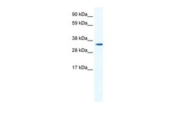Aviva Systems Biology Corp HOXB1 Antibody - N-terminal region (ARP36888_T100)