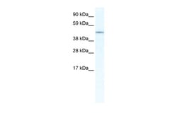 Aviva Systems Biology Corp IRX3 Antibody - N-terminal region (ARP36905_T100)