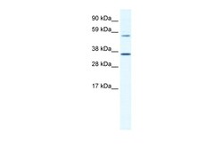 Aviva Systems Biology Corp MESP2 Antibody - C-terminal region (ARP36921_T100)