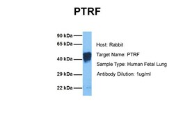 Aviva Systems Biology Corp CAVIN1 Antibody - middle region (ARP36965_T100)
