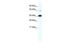Aviva Systems Biology Corp RELB Antibody - middle region (ARP36969_T100)