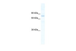 Aviva Systems Biology Corp SIN3B Antibody - N-terminal region (ARP36976_T100)