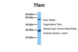 Aviva Systems Biology Corp TFAM Antibody - middle region (ARP36992_P050)