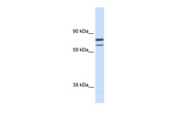 Aviva Systems Biology Corp ZFPM1 Antibody - N-terminal region (ARP37001_P050)