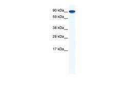 Aviva Systems Biology Corp ZFY1 Antibody - middle region (ARP37003_T100)